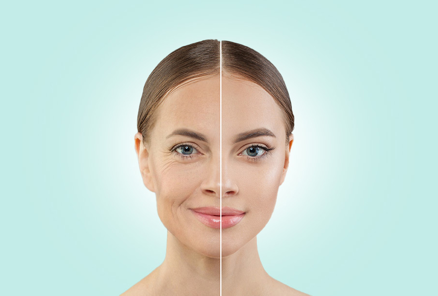 Anti-aging treatments - Microcurrent facials in Encino